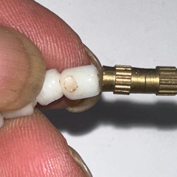 Vintage 15.5" Millefiori Glass Bead Choker Necklace Made in India White Beads - Picture 6 of 8